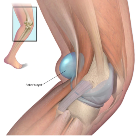 tendon behind knee