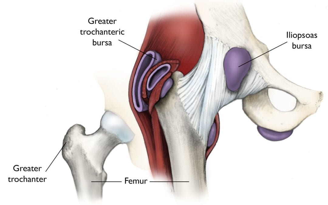 So your Doctor said you have Bursitis: What does that mean?