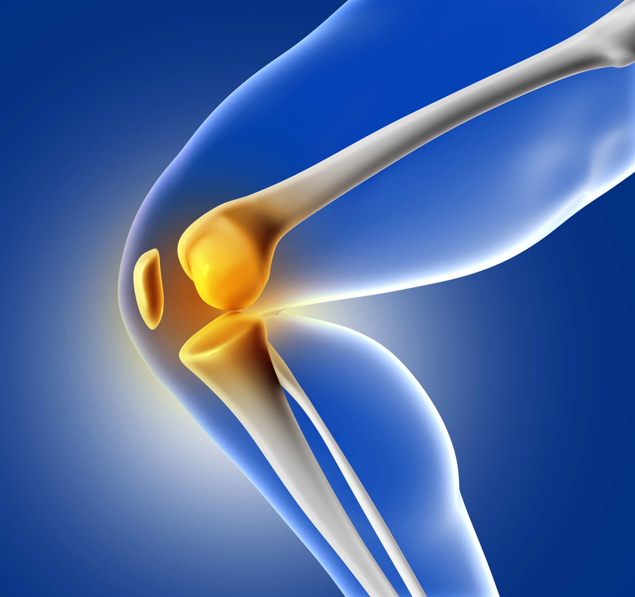 Knee pain illustration